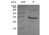 Recombinant Human IA2/PTPRN Protein (aa 607-Asn686 & aa 795-888, His Tag)