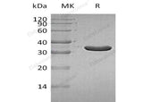 Recombinant Human IA2/PTPRN Protein (aa 687-979, His Tag)