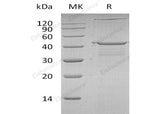 Recombinant Human IGF2BP2 Protein (His Tag, N-T7 Tag)