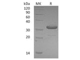 Recombinant Human IgG1 Fc Protein (Active)