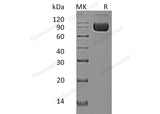 Recombinant Human IL-1RAcP/IL1R3 Protein (Fc & His Tag)