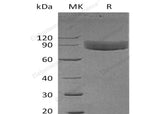 Recombinant Human IL1R1/CD121a Protein (Fc Tag)