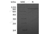 Recombinant Human IL1R2/CD121b Protein (Fc Tag)