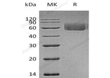 Recombinant Human IL-1RL2 Protein (His Tag)(Active)