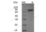 Recombinant Human IL10RB/IL10R2 Protein (Fc Tag)