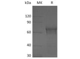 Recombinant Human IL15RA/IL-15RA Protein (Fc Tag)(Active)