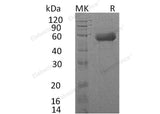 Recombinant Human IL18RAP/IL1R7 Protein (His Tag)