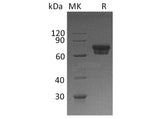 Recombinant Human IL2Ra/CD25 Protein (Fc Tag)(Active)