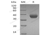 Recombinant Human IL-2RB/CD122 Protein (His Tag)