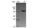 Recombinant Human IL-2RB/CD122 Protein (Fc Tag)(Active)