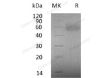 Recombinant Human IL2RG/CD132 Protein (Fc & His Tag)