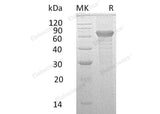 Recombinant Human IL-20RB Protein (Fc Tag)