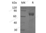 Recombinant Human IL-20RA/IL-20R1 Protein (Fc Tag)