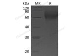 Recombinant Human IL-23 Recetor/IL-23R Protein (His Tag) 