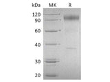 Recombinant Human IL-23 Recetor/IL-23R Protein (Fc Tag)(Active)