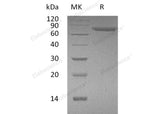 Recombinant Human PGRL/IGSF8 Protein (His Tag)