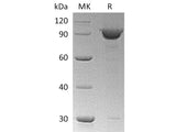 Recombinant Human KPNB1 Protein (His Tag) 