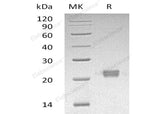 Recombinant Human ITPase/ITPA Protein (His Tag)