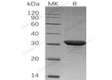 Recombinant Human IMP1/IMPA1 Protein (His Tag)