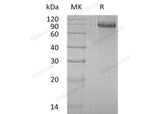 Recombinant Human INPP1 Protein (His Tag)