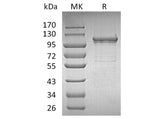 Recombinant Human IDE/Insulysin Protein (His Tag)