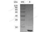 Recombinant Human IGF-1/IGF1 Protein (Active)