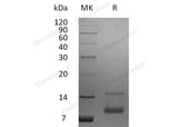 Recombinant Human IGF-1/IGF1 Protein (aa 52-118)(Active)