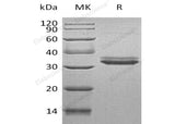 Recombinant Human IGFBP-4/IGFBP4 Protein (His Tag)