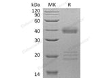 Recombinant Human IGFBP-5/IGFBP5 Protein (His Tag)