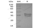 Recombinant Human ITM2B Protein (His Tag)