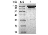 Recombinant Human ICAM-1/CD54 Protein (Fc Tag)