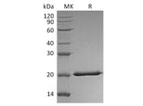 Recombinant Human Interferon Lambda-2/IL-28A Protein (His Tag) 