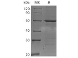 Recombinant Human IRF5 Protein (His Tag)