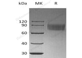 Recombinant Human IFNAR1/IFNAR Protein (His Tag)(Active)