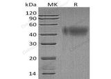 Recombinant Human IFNAR2 Protein (His Tag)