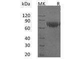 Recombinant Human IFNAR2 Protein (Fc Tag)