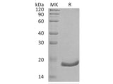 Recombinant Human Interferon α-6/IFNA6 Protein (His Tag)