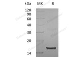 Recombinant Human Interferon γ/IFNG Protein