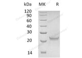 Recombinant Human Interferon ω-1/IFNW1 Protein (His Tag)