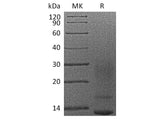 Recombinant Human Interleukin-16/IL-16 Protein