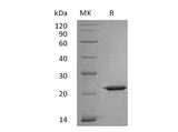 Recombinant Human Interleukin-18/IL-18 Protein (His Tag)