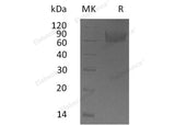 Recombinant Human IL18BP Protein (Fc Tag)