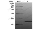 Recombinant Human IL-1 beta/IL1B Protein