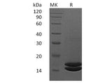 Recombinant Human Interleukin-2/IL-2 Protein (His Tag)(Active)