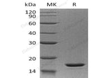 Recombinant Human Interleukin-20/IL-20 Protein