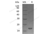 Recombinant Human Interleukin-21/IL-21 Protein (Active)