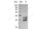 Recombinant Human Interleukin-25/IL-25 Protein (His Tag)