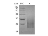 Recombinant Human Interleukin-3/IL-3 Protein (Human Cells, His Tag)(Active)