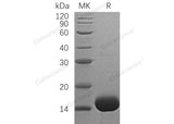 Recombinant Human Interleukin-3/IL-3 Protein (E.coli, His Tag)(Active)