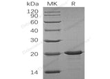 Recombinant Human Interleukin-33/IL-33 Protein (His Tag)